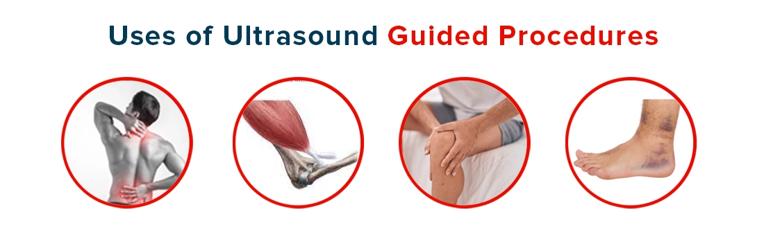 Uses of Ultrasound Guided Procedures